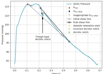 Fig. 1: The grey shear line misidentifies the dicrotic notch, due to P (min dP/dt) being too close to P max 