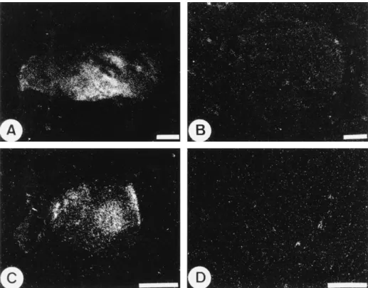 Figure 6 In vitro autoradiographical distribution of [ 125 I]-iodosulpride binding (scale: line  1 mm: (A) Total binding in a control prolactinoma (P4)