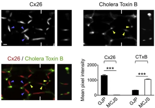 Fig. 2. Cx26 assembles into non-lipid raft GJPs. Cx26 immunolabelling and Cholera Toxin B staining of inner sulcus cells of a newborn mouse