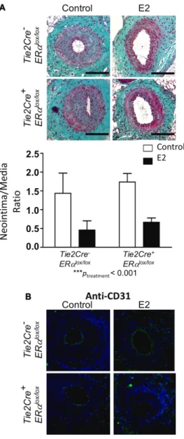 Figure 3. Loss of endothelial estrogen receptor α (ERα)  expression does not affect the action of E2 action on intimal  hyperplasia