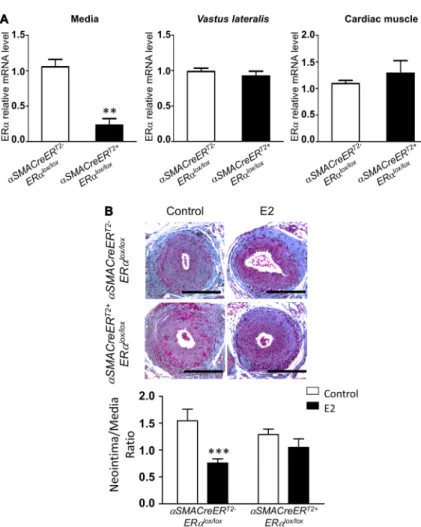 Figure 4. 17β-Estradiol (E2) decreases intimal  hyperplasia through its specific action on  smooth muscle cells