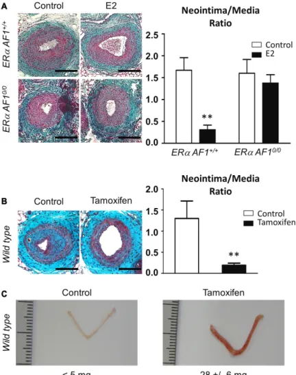 Figure 6. Activation function (AF) 1 of estrogen  receptor α (ERα) is necessary for the prevention  of intimal hyperplasia by 17β-estradiol (E2)