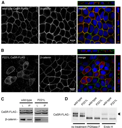 Fig. 7. Expression of human wild-type and the P221L active mutant of the CaSR in MDCK cells.