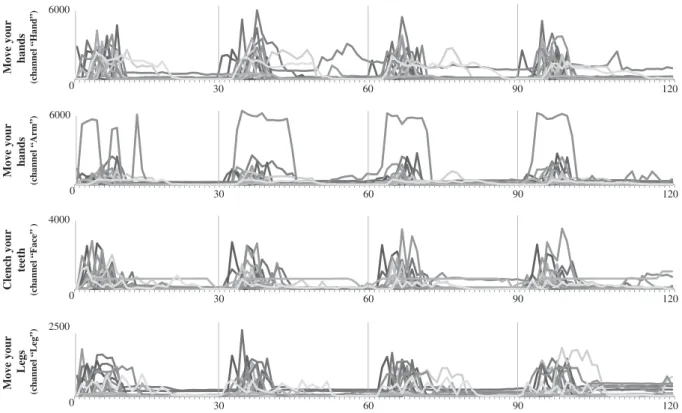 Figure 1. EMG activity in controls (n ¼ 18). This figure illustrates the amplitude (in mv; y-axes) of the EMG activity across trials (n ¼ 4) at the channel matching the target command (e.g