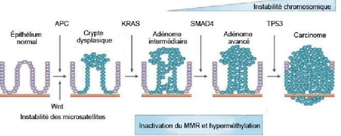 Figure 5. Modèle simplifié de la progression adénome-carcinome 