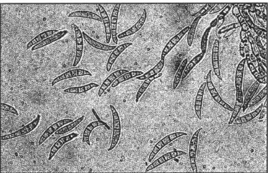 Figure 6:  Macroconidies de Fusarium culmorum. 