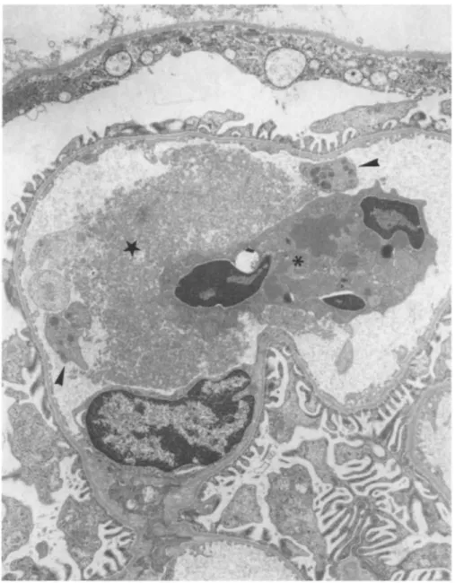 Fig. 4. Electron microscopy of a glomerular capillary loop from a rat intra-aortically injected with 500 μg of human pIgA-ConA complexes