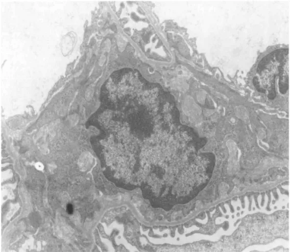 Fig. 6. Electron microscopy of a mesangial area from a rat injected intra-aortically with 500 μg of human pIgA-ConA complexes