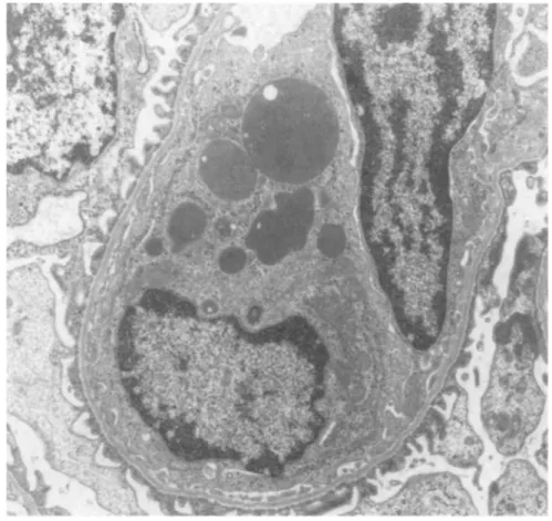 Fig. 7. Electron microscopy of a capillary loop from a Sprague-Dawley rat injected with 500 μg of human pIgA-ConA complexes