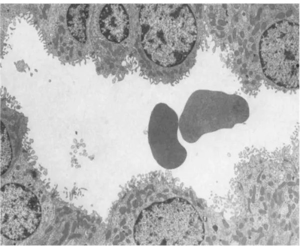 Fig. 8. Electron microscopy of a kidney from a rat intraortically injected with 500 μg of human pIgA- pIgA-ConA complexes