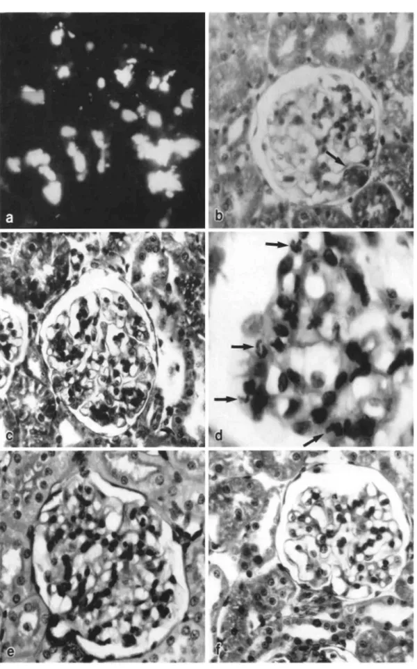 Fig. 3. (a) Immunofluorescence microscopy of a glomerulus from a rat injected intra-aortically with 500 μg of human pIgA-ConA complexes