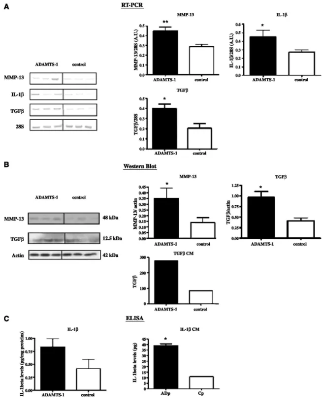 Figure 5: ADAMTS-1 affects the production of stromal reaction regulators.  RT-PCR (A), Western blot (B), or ELISA (C)  analyses were done to measure MMP-13, TGF-β, or 1L-1β levels in tumor tissues (n = 30)