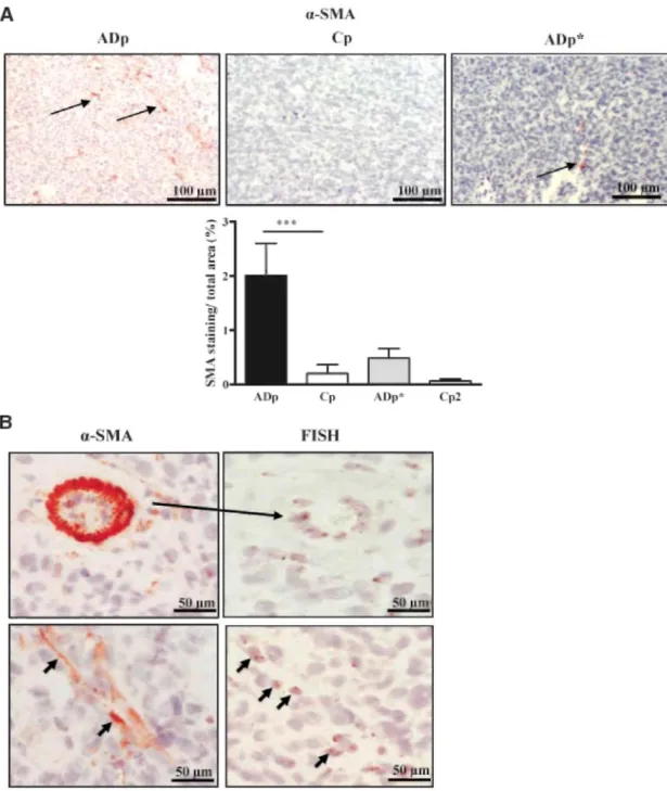 Figure 3: ADAMTS-1 promotes the recruitment of host cells in tumors.  A. α-SMA immunostaining done on tumor sections  derived from ADAMTS-1 (ADp), control (Cp) populations, cells overexpressing a proteinase-dead ADAMTS-1 (ADp*), and corresponding  control 