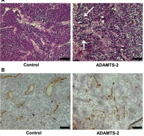 Fig. 10 Immunohistological examination of control and ADAMTS-2-expressing tumors. a Paraffin sections of  tumors formed by control or by ADAMTS-2-expressing cells were stained with hematoxylin and eosin stain  (H&amp;E)