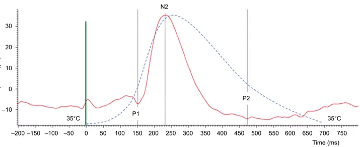 Figure 1 Illustrative CHEP recording (20 averaged responses) in an HS (continuous red curve)