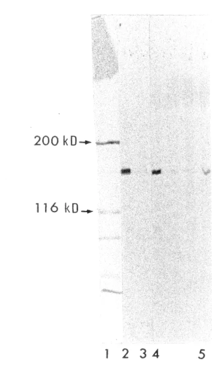 Illustration  de  la  figure  1 