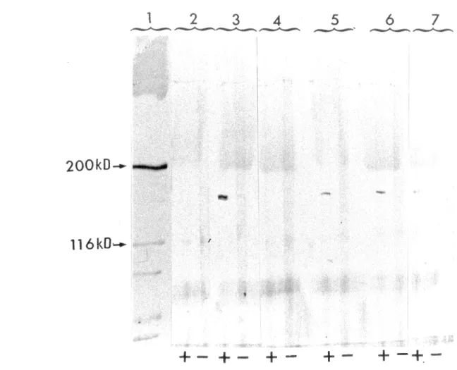 Illustration  de  la  figure  4 