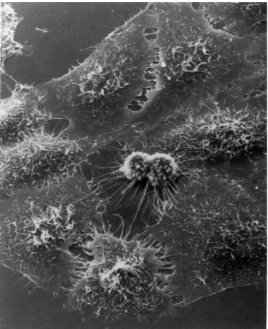 Figure 3.14: Cellule HeLa observée au microscope électronique. [Wikipédia] 