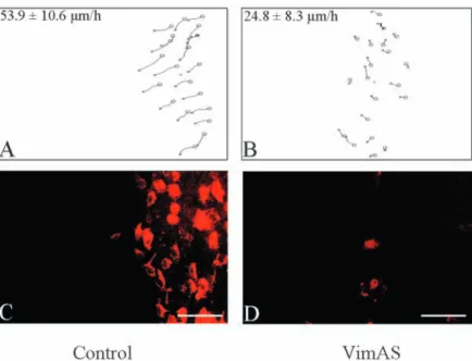 Fig. 7. Reduction of both vimentin expression and cell migration speed by vimentin antisense transfection