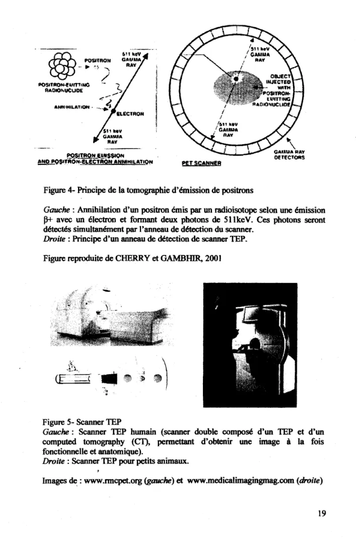 Figure 4- Principe de la tomographic d'emission de positrons 