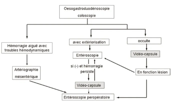 Fig. 6. Stratégie d’utilisation de la vidéo-capsule dans les hémorragies digestives.