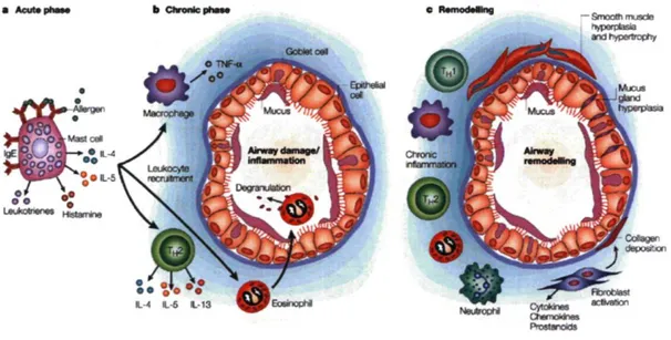 Figure 3. L'inflammation bronchique dans l'asthme. [Gern JE, Busse WW. Relationship of 