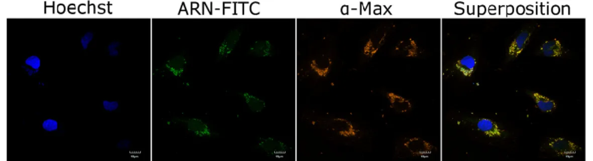 Figure 6 : Livraison d’ARN fluorescent par Max*VL dans des cellules HeLa  Photos de microscopie confocale obtenus par Martin Montagne