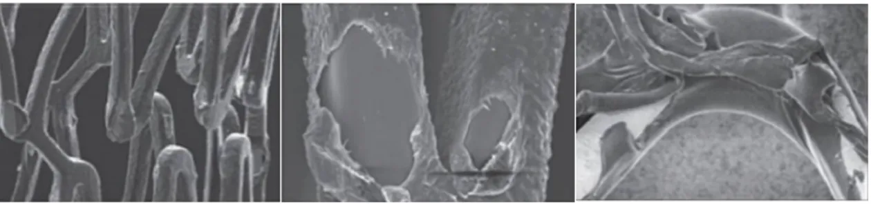 Figure 2.3. Examples of commonly encountered coating defects, where the polymer matrix  has delaminated from the stent
