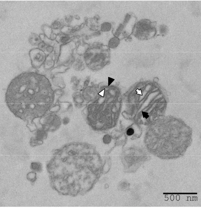 Figure  6  :  Aspect  des  mitochondries  purifiées.  La  morphologie  de  mitochondries  murines 