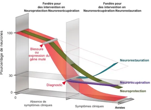 Figure 1.3 : Représentation les différents temps d’intervention dans la maladie de  Parkinson