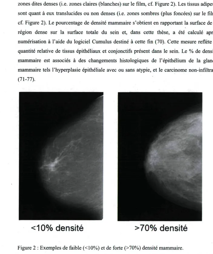 Figure 2 : Exemples de faible (&lt;10%) et de forte (&gt;70%) densité mammaire. 