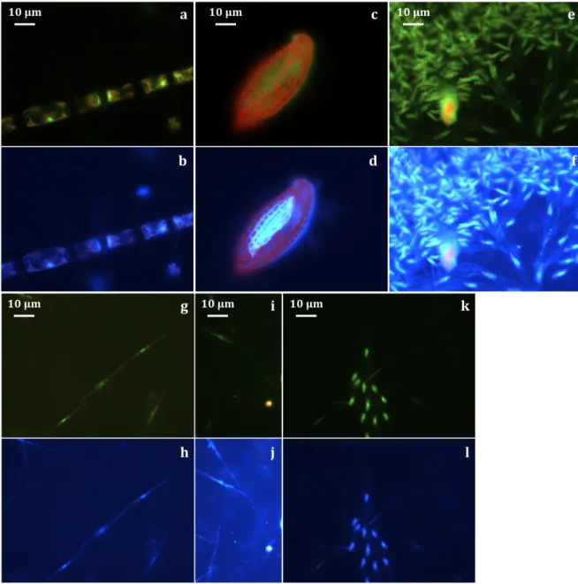 Figure 3.6 – Pictures from epifluorecence microscopy on DAPI slides under blue (a,c,e,g,i,k) and UV (b,d,f,h,j,l) light excitation