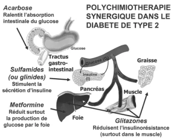 Figure 1 : Illustration des organes cibles de l’action des 3 classes pharmacologiques proposées dans la triple thérapie du diabète de type 2