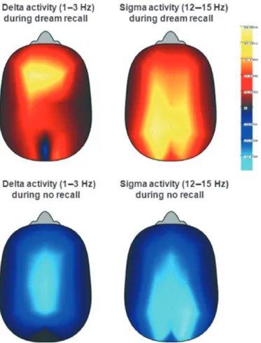Figure 5. Top panel: left and right panels illustrate, respectively, the topographical distribution of non-rapid eye movement (NREM) delta (1–