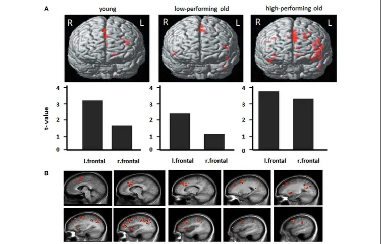 FIGURE 4 | Frontal activity changes in young and older
