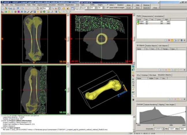 Figure 2.7 Scan of a pig femur by CT and Mimics software  