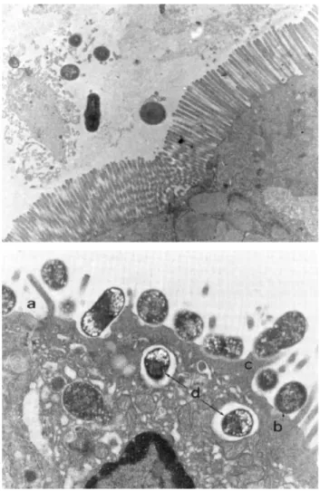 Fig. 1 Intact intestinal microvilli and attaching/effacing lesions at the electron microscope (15 680·)