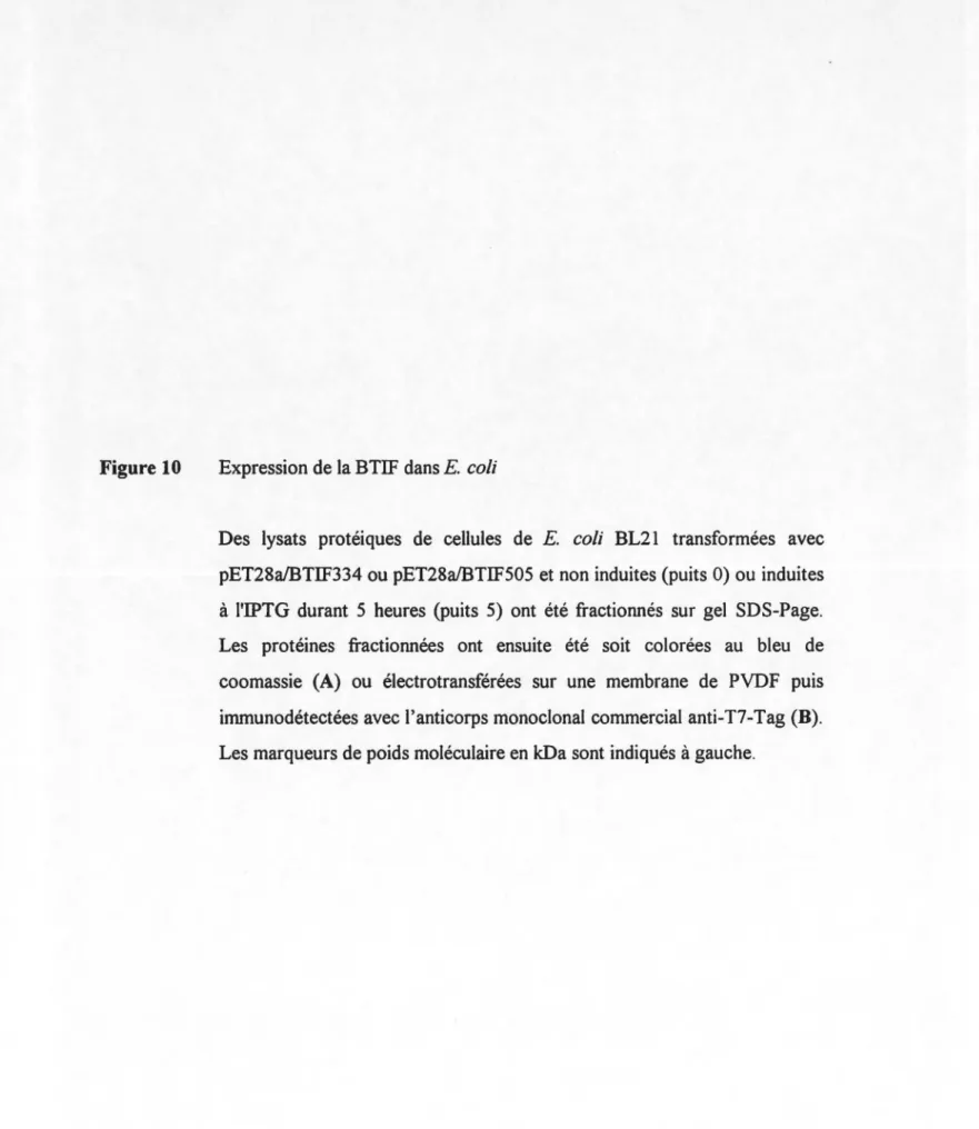 Figure 10  Expression de la BTIF dansE.  coli 