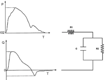 Fig. 4: Illustration of the operating point of the ventricular  pump. 