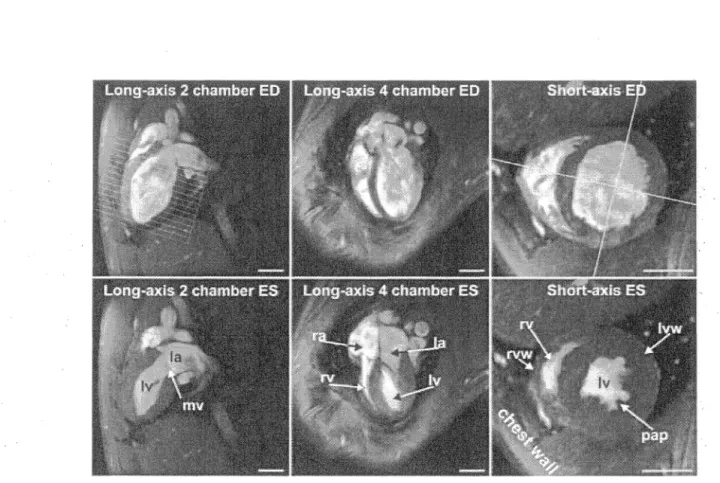 Figure 3.2 - Exemple d'images d'un coeur de rat obtenues avec une séquence FLASH  à  9.4T