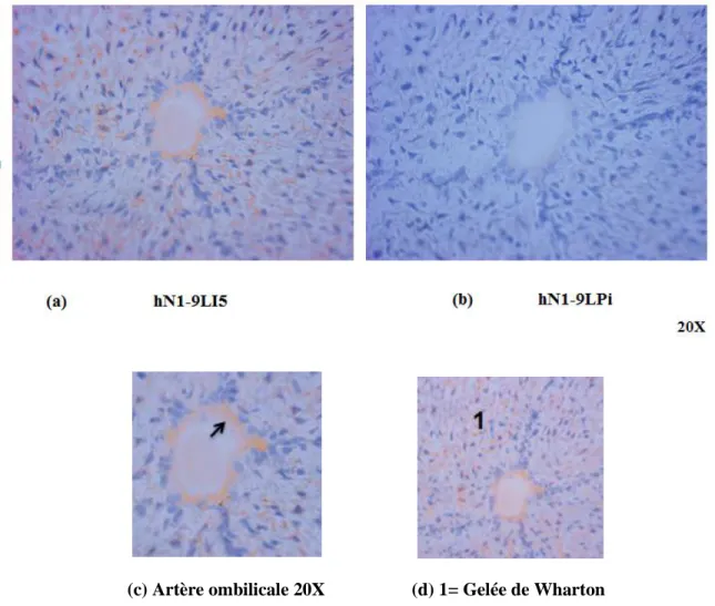 Figure 13: Immunolocalisation de la NTPDase1 dans l’artère du cordon ombilical  humain avec l’anticorps hN1-9LI5 en cryosection 