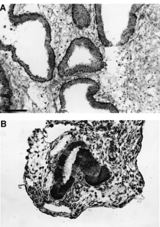 Figure 1. VEGF immunostaining. (A) In eutopic endometrium during the early secretory phase