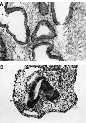 Figure 1. VEGF immunostaining. (A) In eutopic endometrium during the early secretory phase