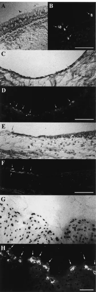 Figure 1 . Immunolocalization of MMP-9 in cryosections of hu- hu-man bronchial tissue samples and cultures of repairing HBEC.