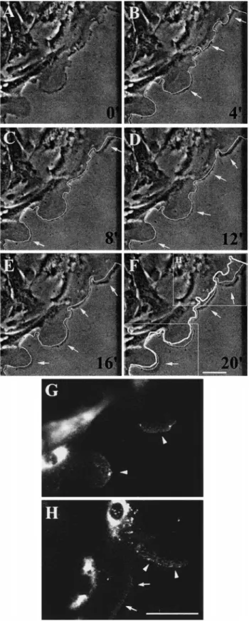Figure 3 . MMP-9 within migrating HBEC accumulates at the tip of extending lamellipodia
