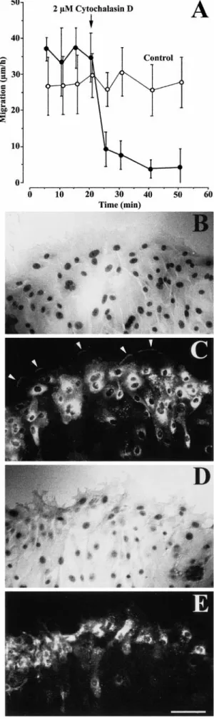 Figure 4. HBEC migration and MMP-9 trafficking to advancing lamellipodia were rapidly inhibited by treatment with  cytochala-sin D