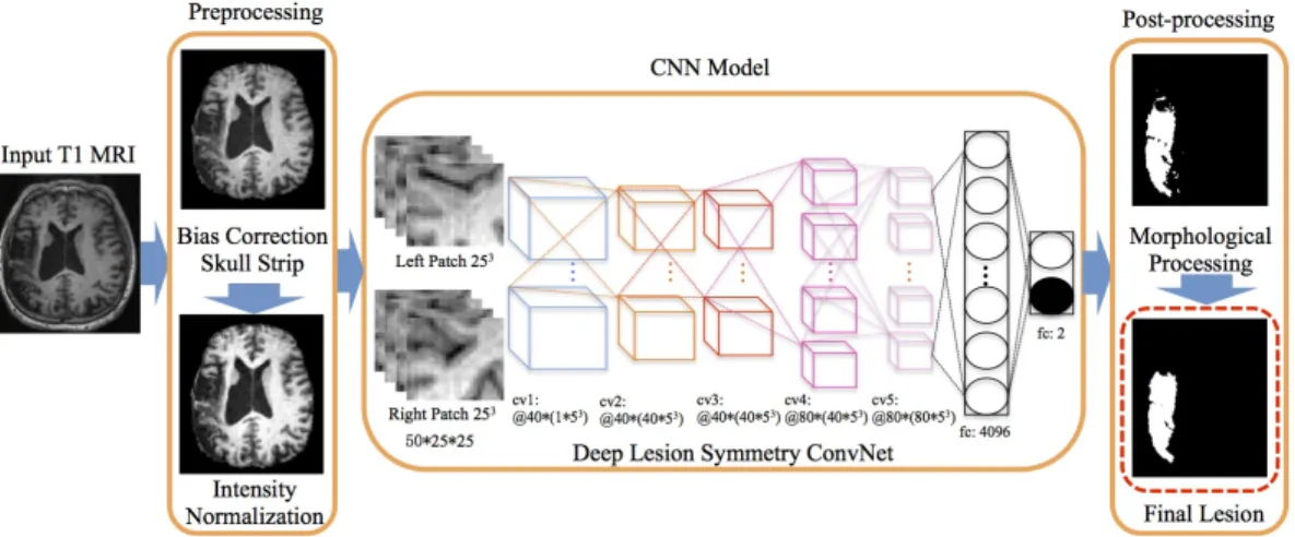 Figure 2.12 Overview of a deep convolutional network for stroke lesion segmentation on MRI images.