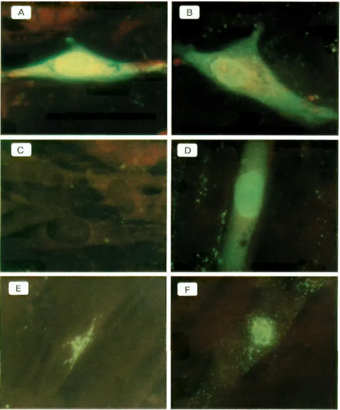 FIG. 2. Immunofluorescence of MRC5 cells infected with VZV and treated (C and D) or not treated (A, B, E, and F) with the inhibitors (Fig