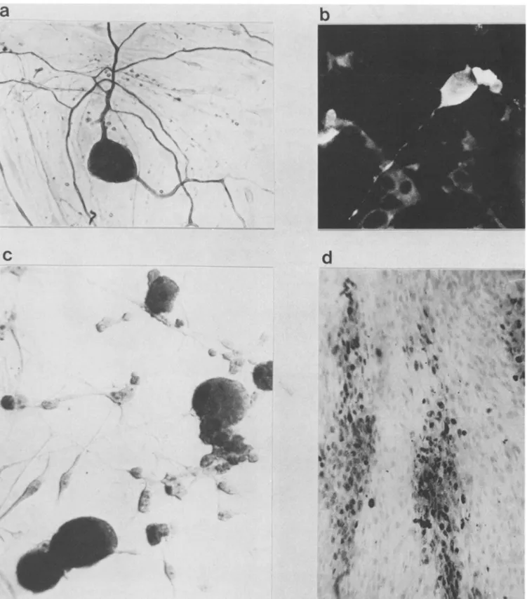 FIG. 1. Indirect immunolabeling and in situ hybridization analysis of adult rat DRG neurons after VZV infection (2 days postinfection).
