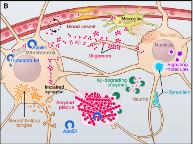 Figure 2. Pathophysiologie de la MA. 